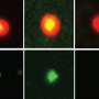 New tool tracks a hidden protein involved in viral infection and cell cleanup