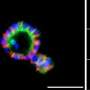 Salivary gland mini-organs grown from pluripotent stem cells offer potential path to treating severe dry mouth